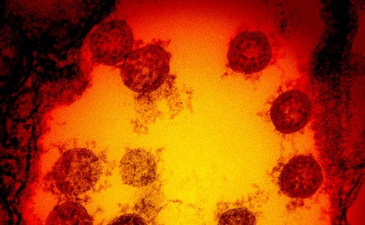 ¿Por qué el coronavirus se propaga ahora con tanta velocidad?