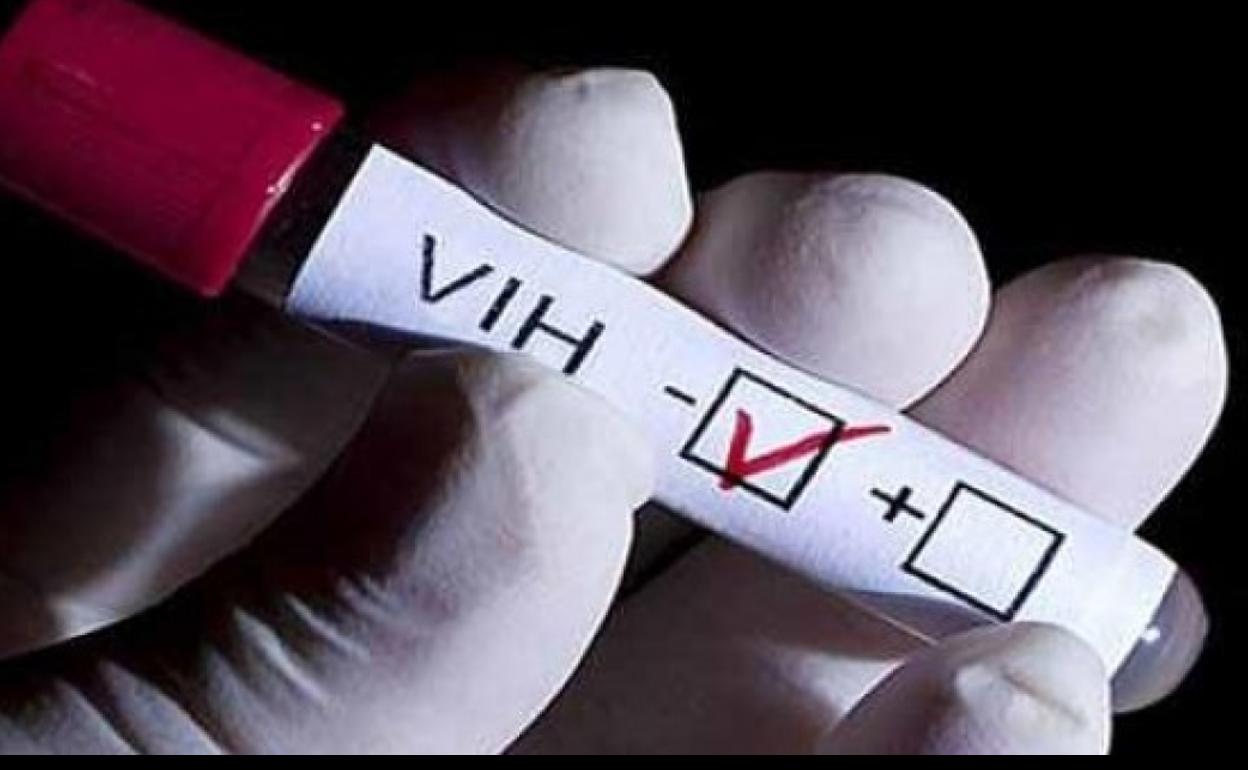 Andalucia implementa el programa Focus para el diagnóstico precoz del VIH y la eliminación de la hepatitis C