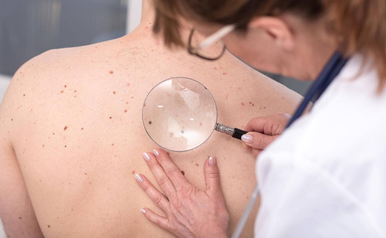 Una dermatóloga examina los lunares en la espalda de una paciente. 