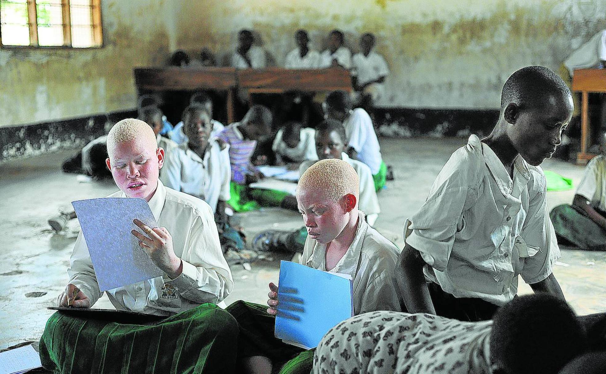 Niños albinos estudian en una escuela de primaria para ciegos de Tanzania, convertida en santuario para quienes sufren falta de pigmentación.