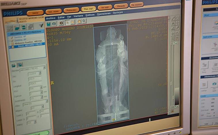 Imagen principal - Finalizando el diagnóstico. 