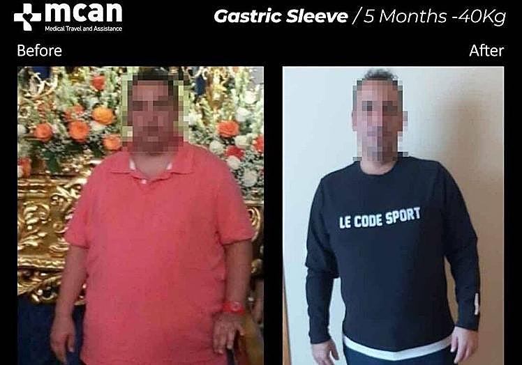 Fotografía publicada en una de las clínicas del «antes y después».