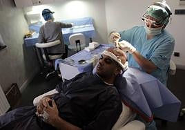 Cirujanos turcos realizan una operación de trasplante de cabello a un hombre.