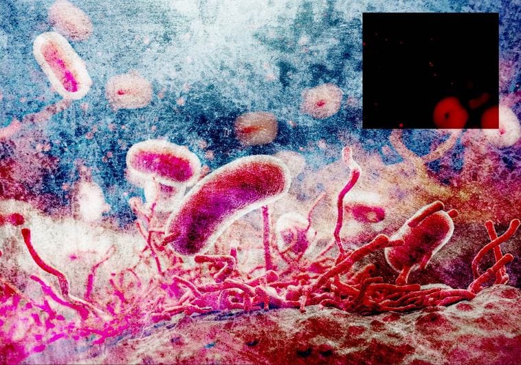 Contagios De Salmonella En Granada: Cómo Se Contagia La Salmonella ...