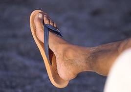 Los riesgos del uso prolongado de sandalias en el verano.
