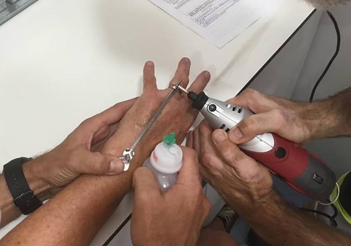 Bomberos retirando el anillo del dedo de la mujer.