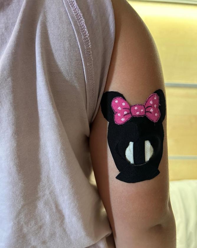 Una niña con un sensor de glucosa en el brazo.