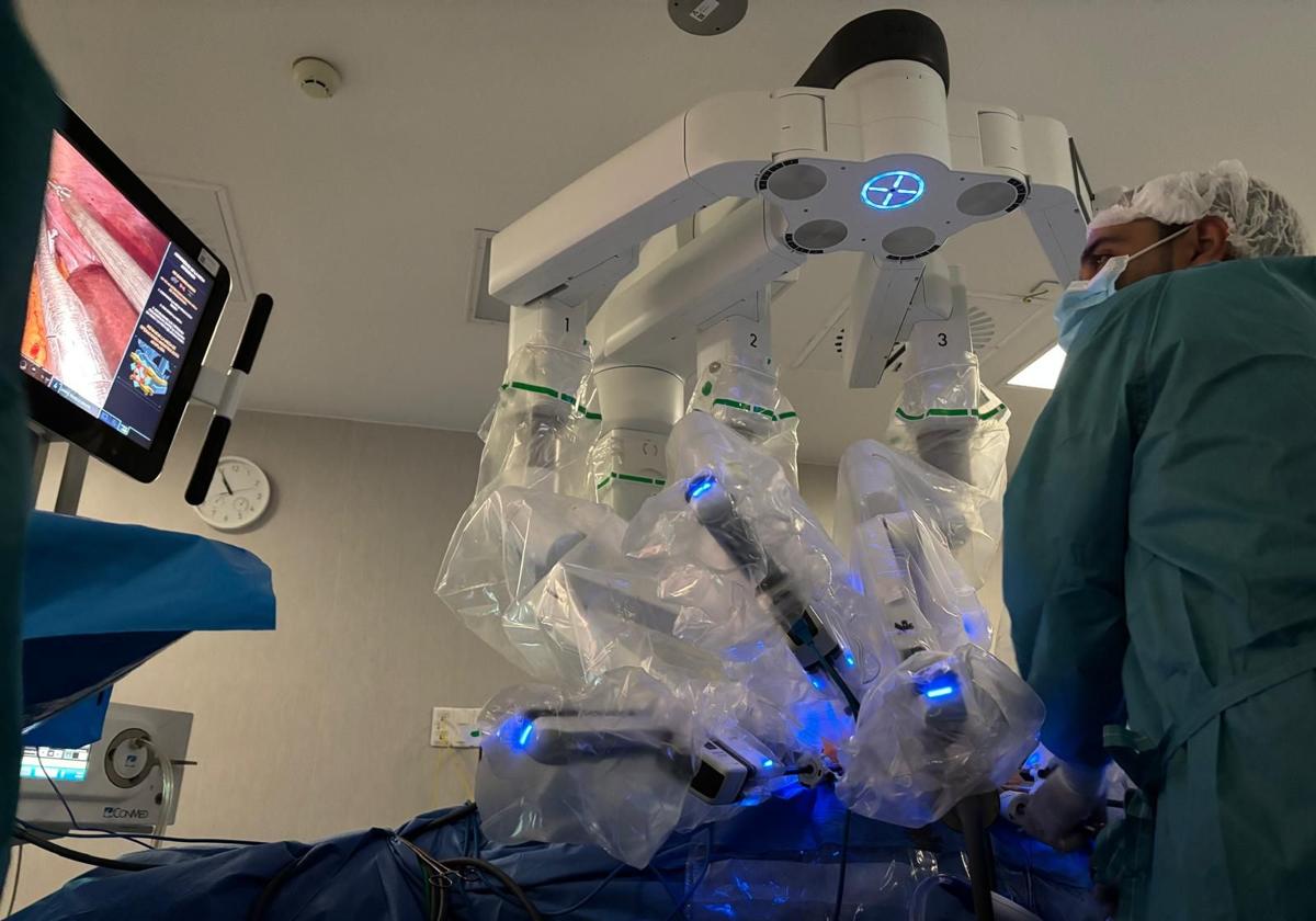 Urología del Hospital de Jaén incorpora dos nuevas cirugías renales robóticas