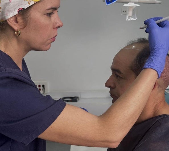 Recupera tu cabello con la técnica más avanzada en Clínica Be, centro de referencia