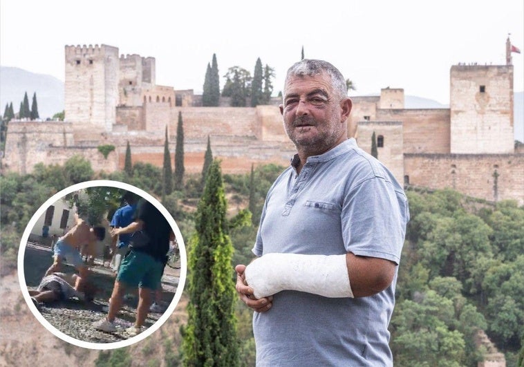 Agustín sufre diversas fracturas por las que tendrá que pasar por quirófano, al menos, dos veces. En la imagen izquierda, momento de la agresión.