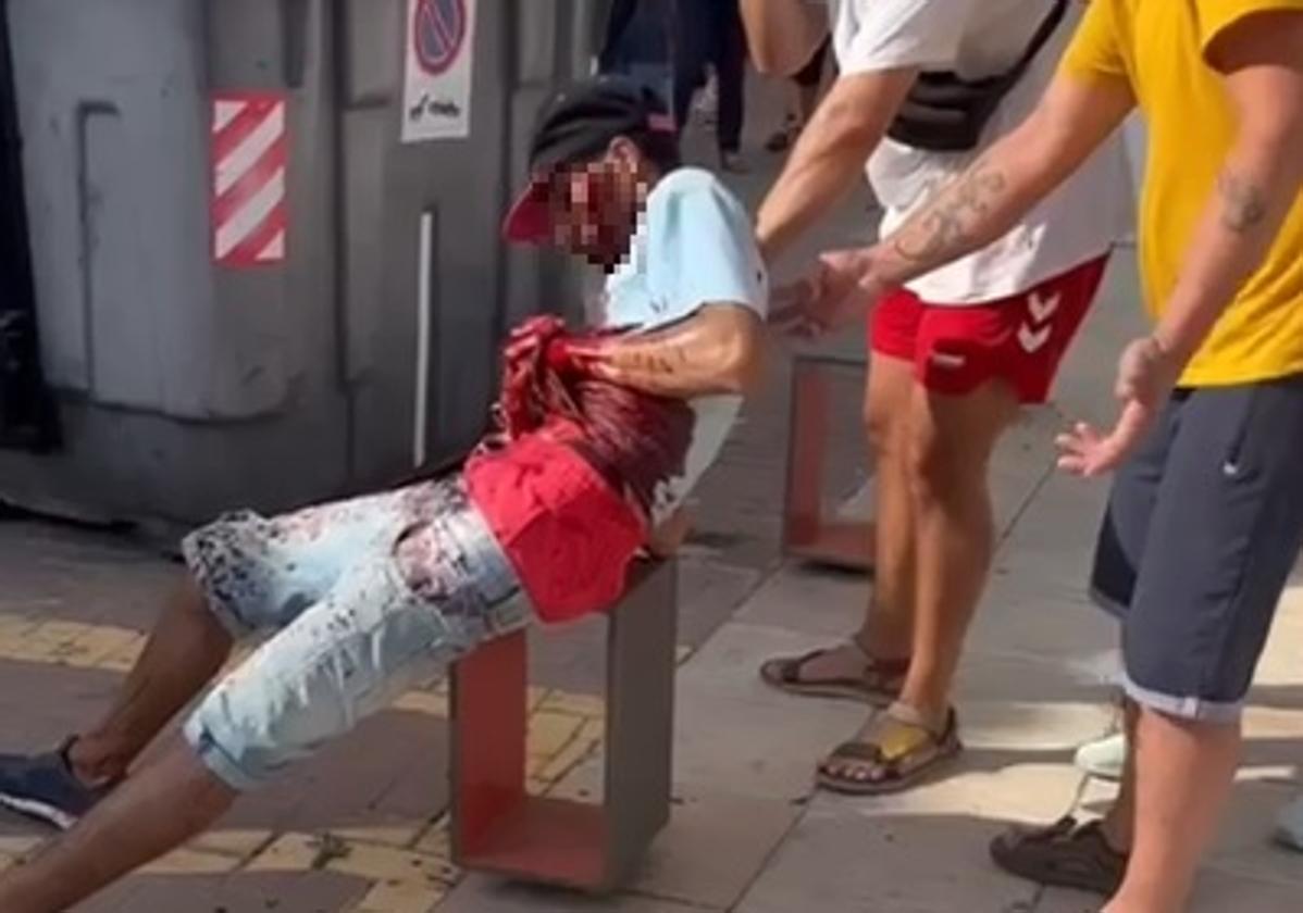 Herido grave un joven en Adra tras recibir varios cortes con un machete, uno de ellos en la cara