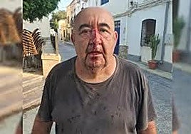 Fiscalía pide dos años y medio para el acusado de agredir al edil de Alsodux