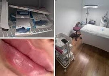 ¿Quiénes son los intrusos en las intervenciones estéticas?