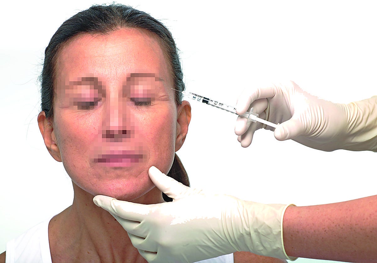 De una alergia a una ceguera: las secuelas de los tratamientos estéticos en centros clandestinos