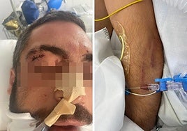 Imágenes del presunto agresor en el hospital.