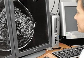 Examen de una mamografía.