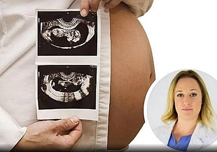 Estos son los alimentos que las embarazadas no pueden comer según una conocida ginecóloga