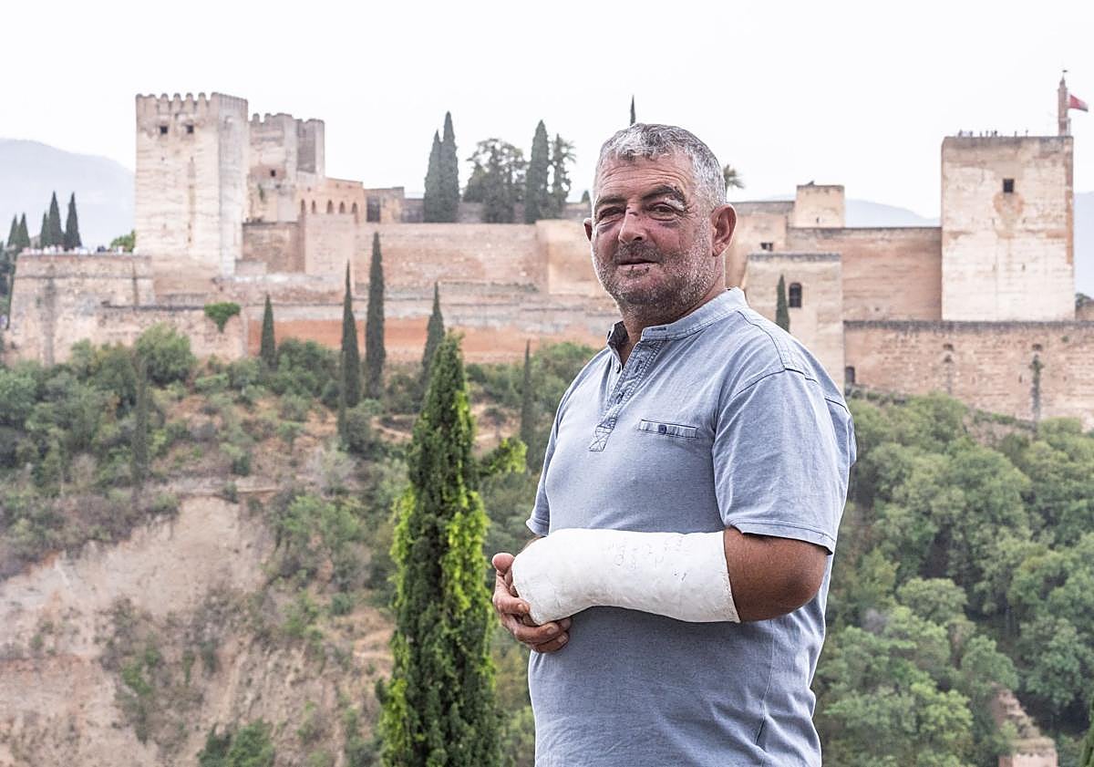 Imagen principal - Agustín días después de la agresión (primera imagen) y este domingo (segunda y tercera imagen).