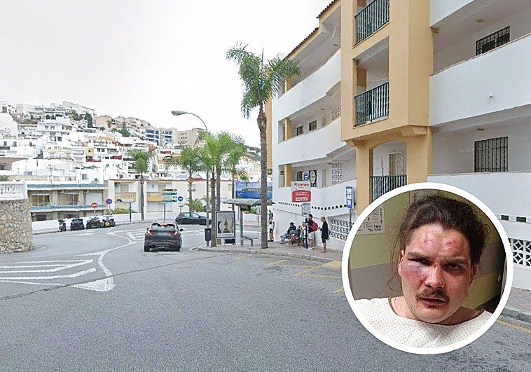 Brutal paliza a un joven en La Herradura mientras esperaba el autobús para ir a Almuñécar: «Casi lo matan»