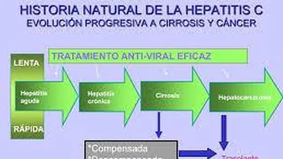 ¡Alarma!: Crece la Hepatitis C como Problema de Salud Pública en México ahora