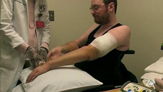 Trasplante cúadruple a un exprofesor: primero las dos piernas y ahora los dos brazos