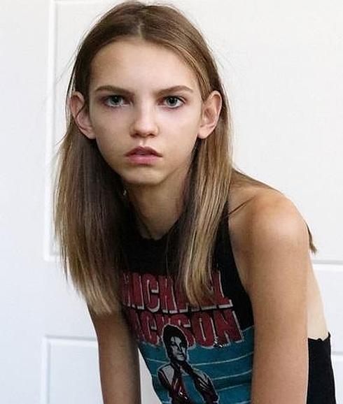 Molly Bair, 'la niña rata' que ahora triunfa en las pasarelas | Ideal