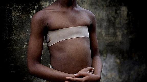 El planchado de pechos es una forma de mutilación sobre el cuerpo de la mujer