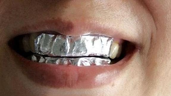 blanquear completamente tus dientes con papel de aluminio |