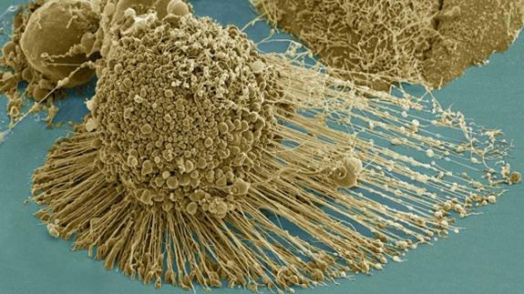 Un equipo de científicos consigue que células cancerígenas mueran 'de hambre'