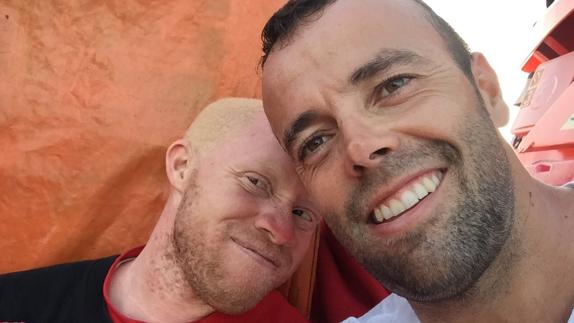 Llega a Motril un joven africano albino que huía en patera