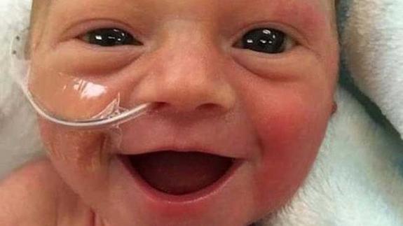 «La vida es preciosa»: la lección de un feliz bebé prematuro