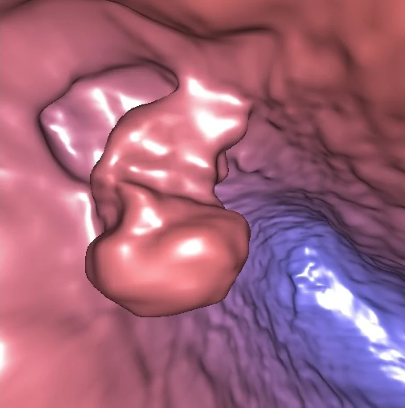 Detectan por vez primera un embarazo ectópico gracias a la realidad virtual
