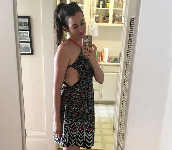 Muestra un vestido de su pasado de anorexia para apoyar a los que sufren esta enfermedad