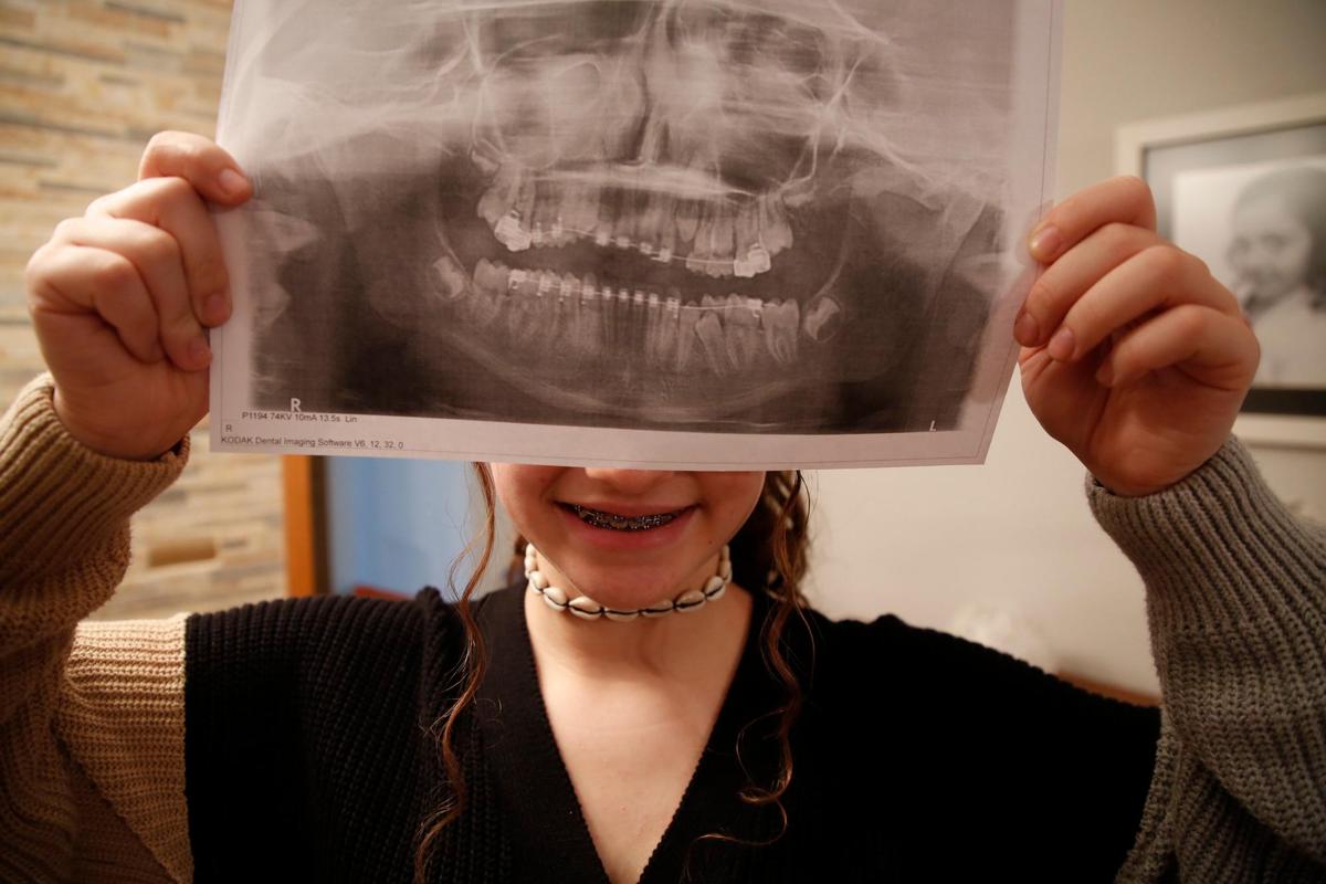 La hija de Mari Mar con una radiografía de su boca.