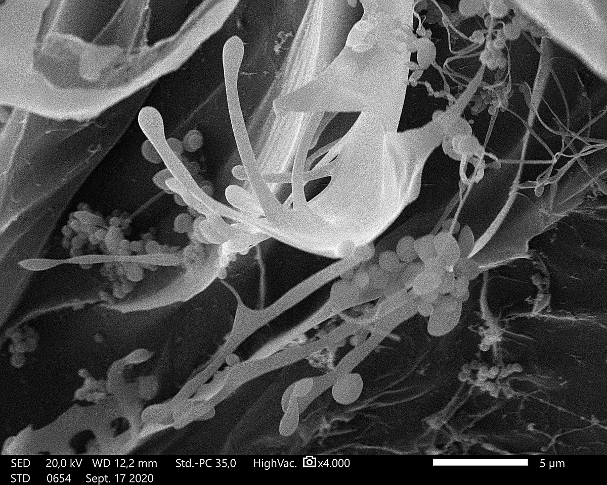 Imagen de la investigación de un hidrogel con aminoácidos creado para estudiar posibles usos de este polímero en el campo de la biomedicina como soporte para el crecimiento celular. | GRUPO DE APLICACIONES BIOMÉDICAS DE INGENIERÍA QUÍMICA