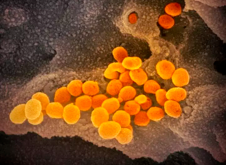 Muestra del virus SARS-CoV-2