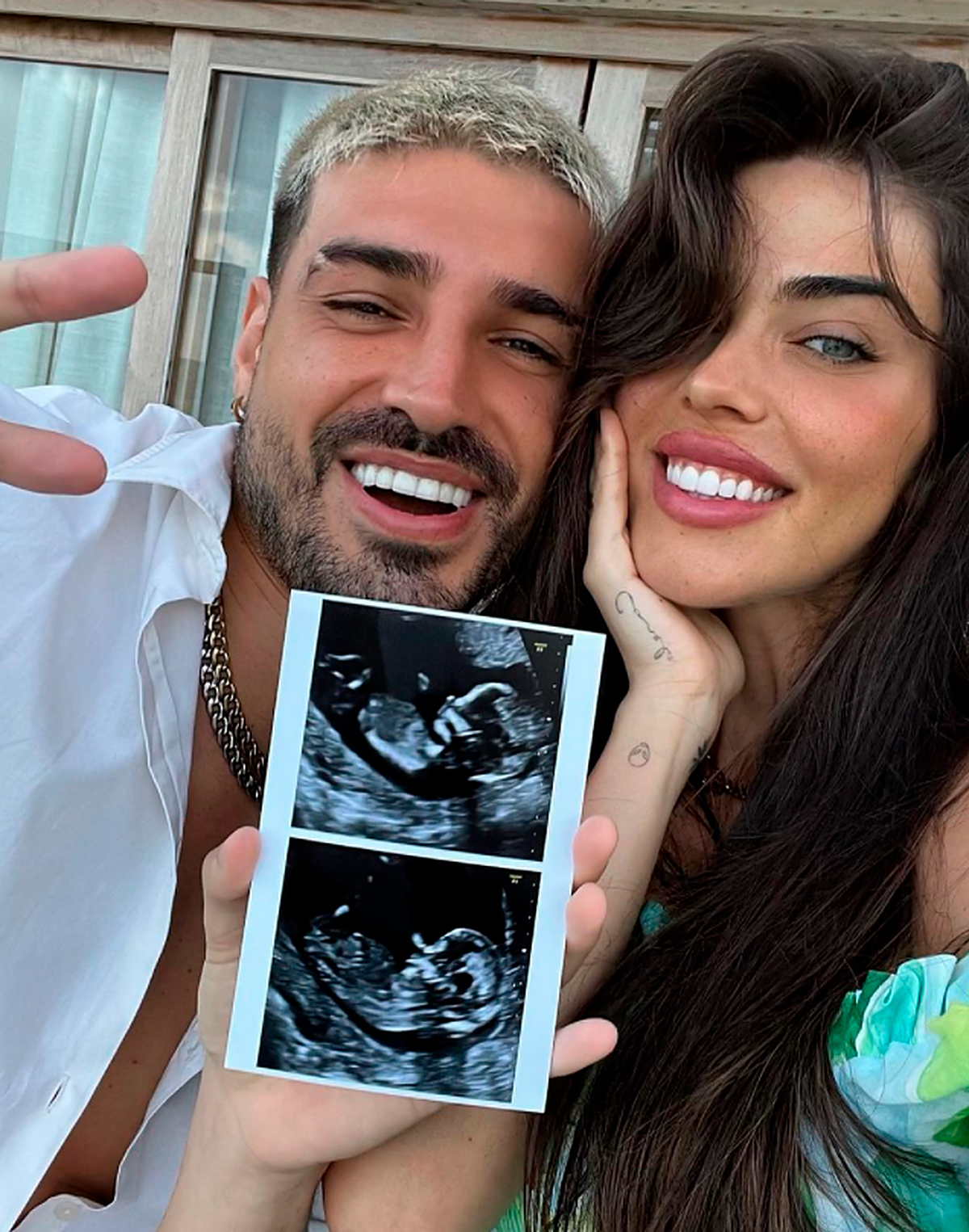 Ambos enseñando una fotografía de una ecografía.