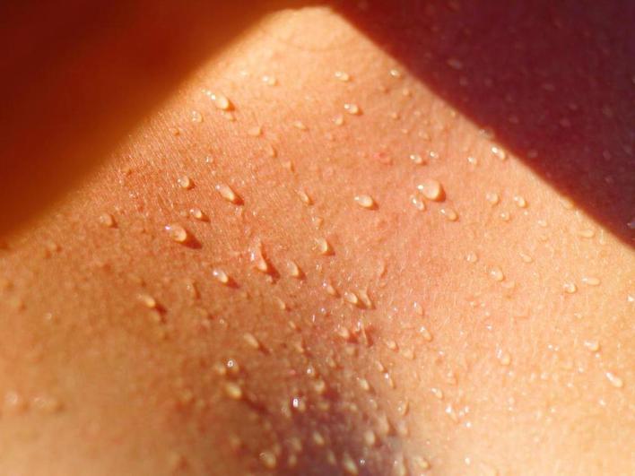 La sudoración puede conllevar una pérdida de hidratación del organismo y también de la piel.