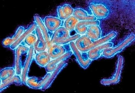 Sanidad descarta la presencia del virus de Marburgo y de ébola en el paciente sospechoso de Valencia