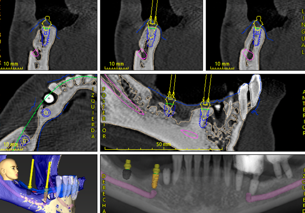 Así se usa la Inteligencia Artificial en odontología