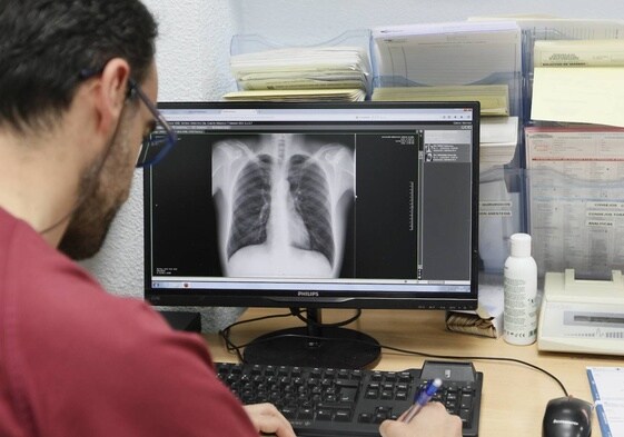 Un urgenciólogo del Hospital analiza una radiografía de tórax.