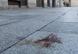 Fotografía de la navaja utilizada en la agresión.