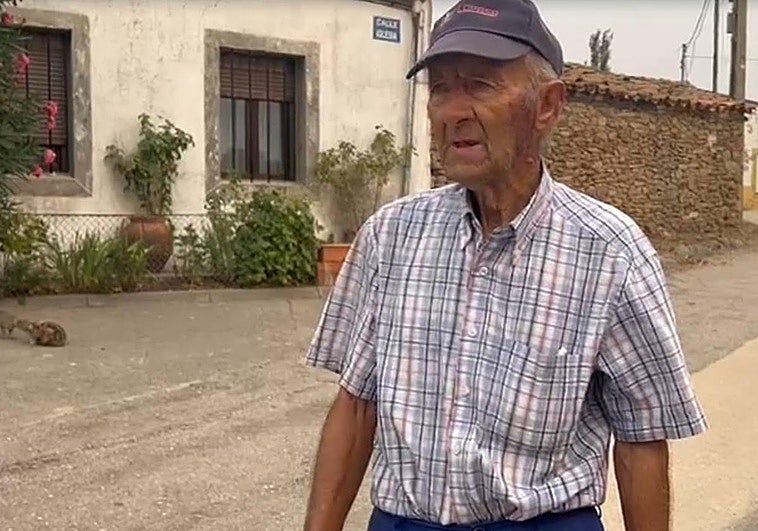 Luis Vicente, con una quemadura en la cara al intentar apagar un fuego.