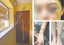 La puerta de 'la casa de los horrores', en el barrio del Carmen, y lesiones de la víctima en ojo, muñecas y tobillo.