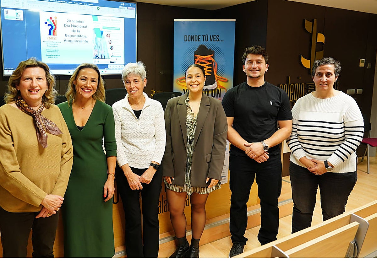Imagen principal - Pilar Hierro, paciente de espondilitis anquilosante: «Perdí mi trabajo y fue muy duro, te sientes como si la enfermedad te quitara todo»