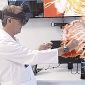 El cirujano Marcelo Jiménez estudia el 'holograma' de una caja torácica a través de las gafas de realidad aumentada.