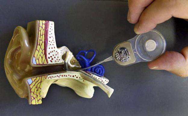 Detalle del dispositivo electrónico que transforma las señales eléctricas en auditivas. 