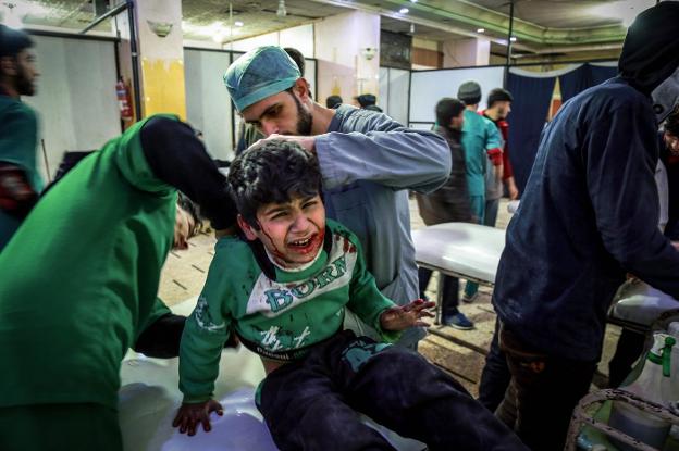 Los servicios médicos atienden a un niño herido en los bombardeos sobre el bastión rebelde. :: afp