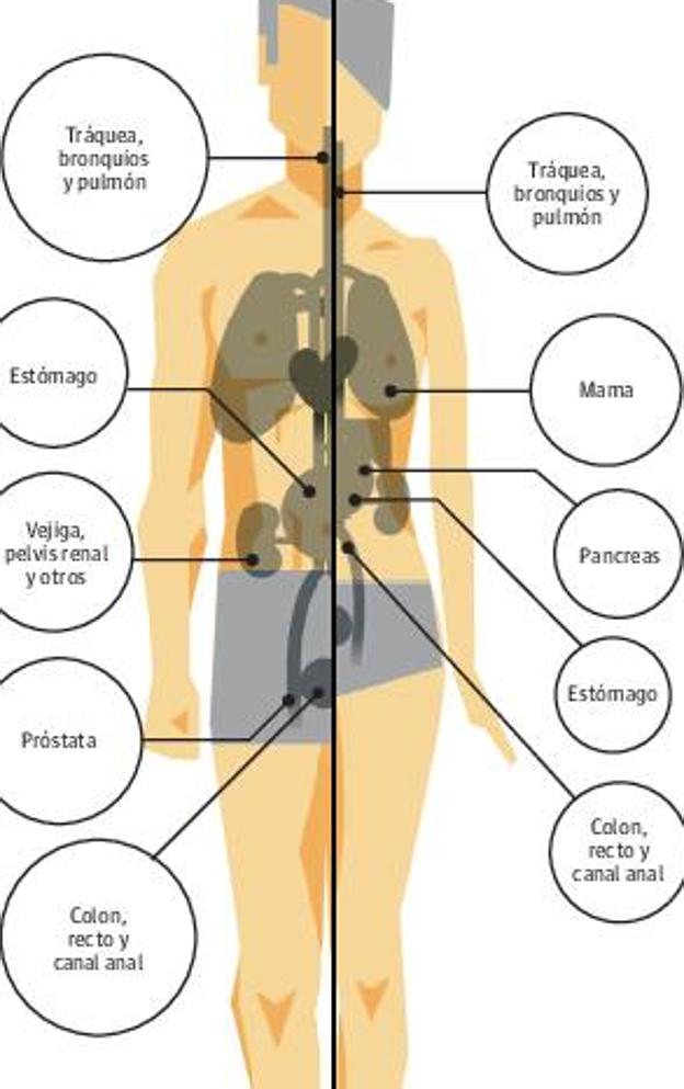 Avanzar en el control del cáncer