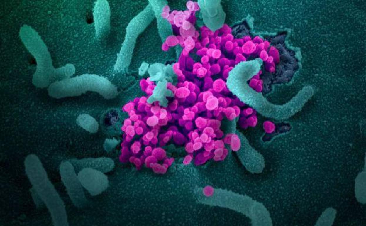 Ilustración del virus del SARS-CoV-2, que causa el COVID-19, a través del microscopio electrónico. 